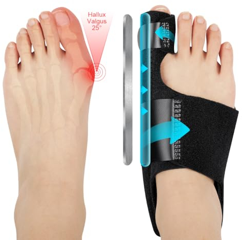 ACWOO Hallux Valgus Korrektur Schiene, 2 Korrektur Schiene und 2x Zehenspreizer, Rutschfester Bunion Zehenspreizer, Korrektur Bandage Socken Bunion Corrector für Damen und Herren