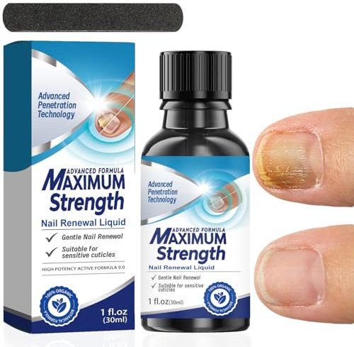 Fungal Nail Treatment, Nail Strengthening Solution, with Cuticle Oil, Magic Liquid - Plant-Based Formula to Improves Brittleness & Discoloration, Nail Tending for Stronger, Healthier-Looking Nails